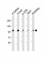 ACO1 Antibody (Center)